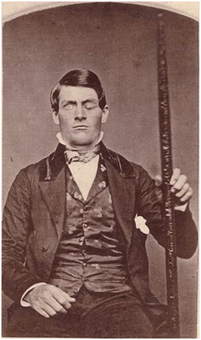 Phineas Gage